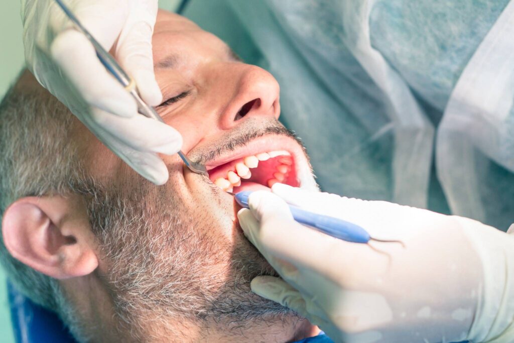 Tooth Extractions